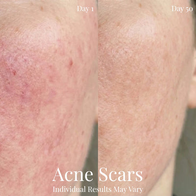 Yume Sculpt Face Mask